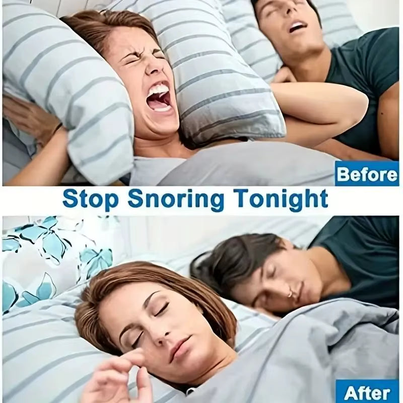 Mini Anti-Snoring Device, Snoring Sleep Anti-Snoring Nose Clip, Anti-Snoring Device, for Better Sleep