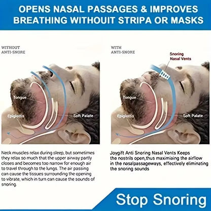 Mini Anti-Snoring Device, Snoring Sleep Anti-Snoring Nose Clip, Anti-Snoring Device, for Better Sleep